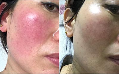 Soothing and Anti-Aging Care Liquid